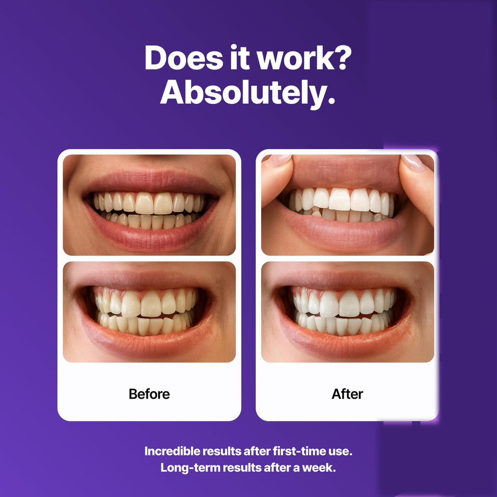 dr dent purple teeth whitening teeth whitening strips