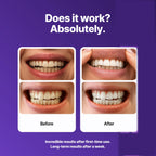 dr dent purple teeth whitening teeth whitening strips